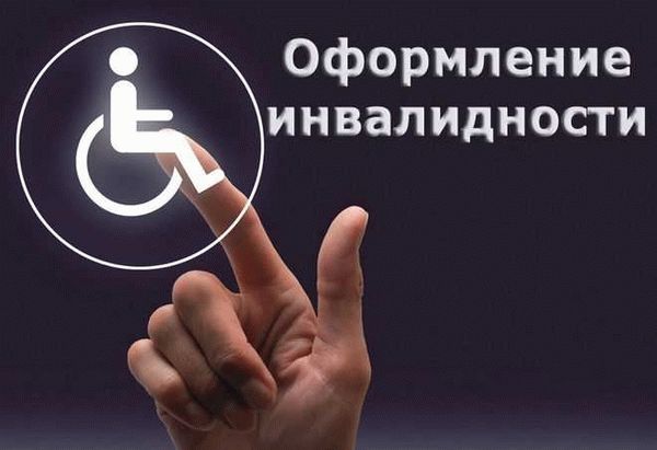 Трудовые права и ограничения для инвалидов второй группы